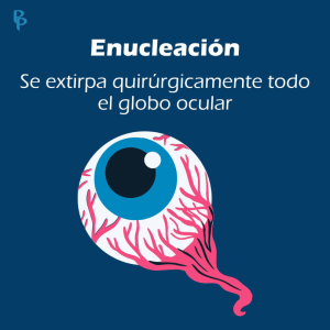 Enucleacion ocular