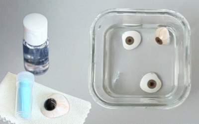 ¿Cómo cuido y limpio mi prótesis ocular?