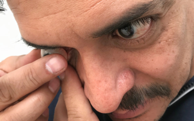 ¿Cómo se coloca una prótesis ocular?