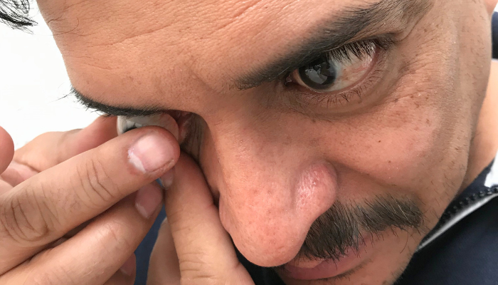 ¿Cómo se coloca una prótesis ocular?