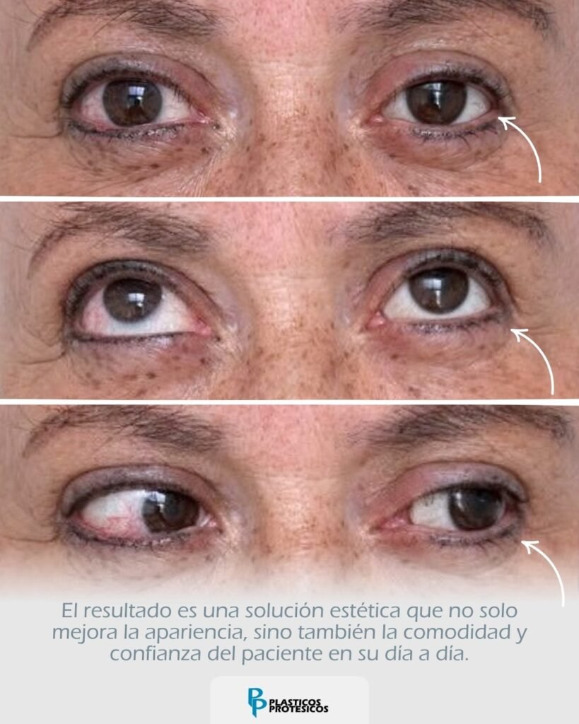Prueba de Movimiento