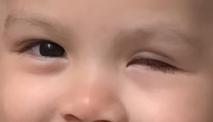 Retinoblastoma en niños: qué es, cómo se detecta a tiempo y qué sigue después